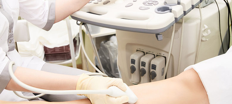 Contraception et risque thromboembolique