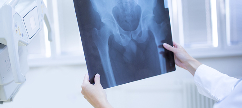 Gros plan sur une radiographie du bassin - La Prévention Médicale Gros plan sur une radiographie du bassin - La Prévention Médicale