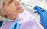 Gros plan sur le visage d'une femme âgée lors de soins dentaires - La Prévention Médicale