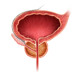 infection, biopsie, prostate