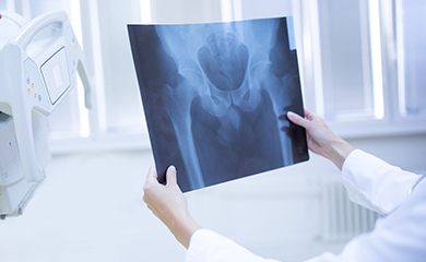 Gros plan sur une radiographie du bassin - La Prévention Médicale Gros plan sur une radiographie du bassin - La Prévention Médicale